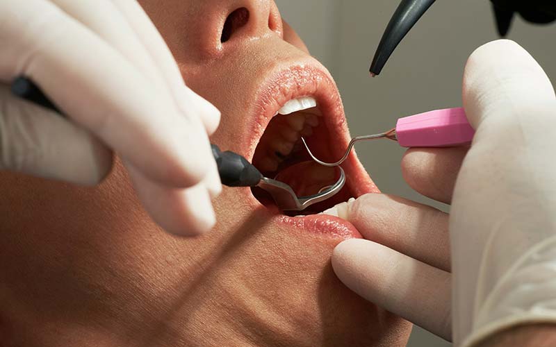 Illustrating Council looks for views on district's NHS dentistry on Info Staging